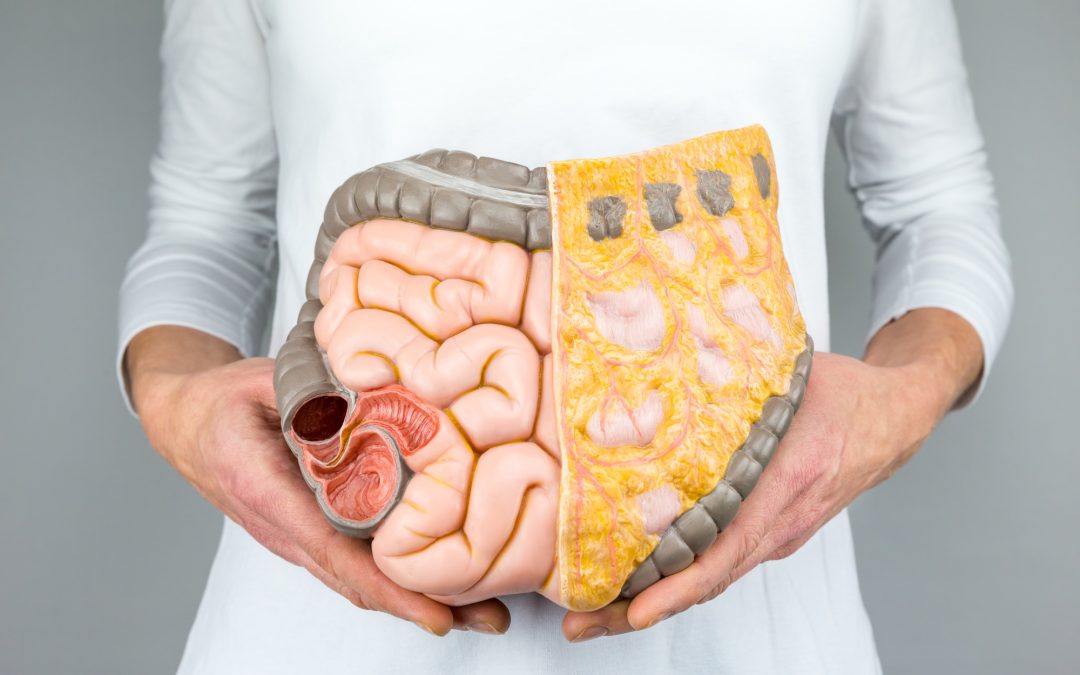 How Do I Know if I Have a Leaky Gut?